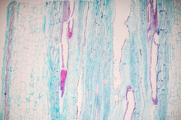 Wall Mural - Plant tissue Structure, section (tissue) of stem plant tissue under a light microscope.