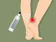 Cooling spray healing muscle Injury ankle pain, Illustration on green background