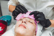 © inna717 - The process of removing the alginate mask from a woman's face. Facial rejuvenation procedure. Skin care in a beauty salon. cleansing the skin.