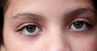 © Marco - Child green eyes macro close-up. Girl face looking at camera
