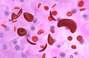 Sickle cell Anaemia (Sickle cell disease SCD) cells in the blood flow - isometric view 3d illustration