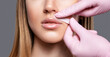 © Dimid - The beautician makes a mustache removal with wax in a young woman. hair removal procedure on a woman’s body.
