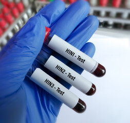 Sticker - Scientist blood Samples for Influenza A virus subtype H1N1, H1N2 and H1N3 test.