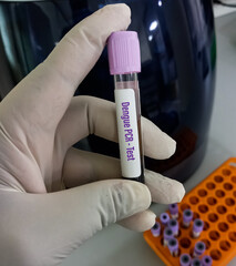 Wall Mural - Blood sample isolated for Dengue Virus PCR test. Dengue viral load.