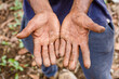 © Aleksandr Rybalko - The overworked hands of a peasant. The hands of an elderly farmer disfigured by hard physical labor.