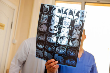 Female middle aged doctor discussing with her senior stroke patient ct-scan images of her brain