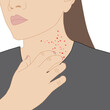 Women scratch the rash itch because of allergies symptoms or nettle or eczema, illustration cartoon