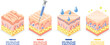 © Macrovector - Skin Injections Isometric Set