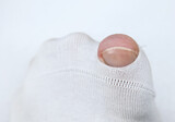 Fototapeta  - Toe visible through hole in broken white sock.