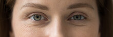 Cropped Image, Horizontal View Female Eyes Look At Camera. Eye-care, Eyesight Regular Check Up Professional Services Clinic Ad, Lenses And Eyewear Store Advertisement, Laser Surgery, Vision Correction