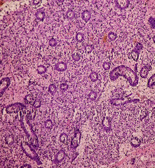 Wall Mural - Endometrial tissue: Photomicrograph of endometrial tissue, proliferative phase in endometrium. Follicular phase.