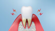 Dental health and gum disease. 3D rendering.
