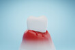Leinwandbild Motiv Bleeding gums and gum disease. Dental health and gingivitis concept. 3D rendering.