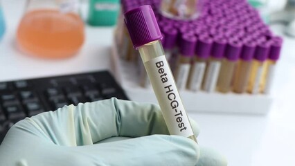 Sticker - Urine samples for testing HCG in the laboratory, urine sample in test tube