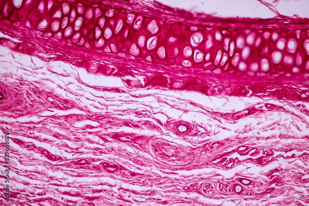 Hyaline cartilage, Elastic cartilage and Bone Human under the ...