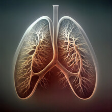 Human Lungs 3D, Secondary Tuberculosis In Lungs, Apical Nodule, 3D Illustration