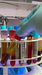 Wall Mural - Centrifuge machine has just centrifuged tubes with blood samples for analysis in the laboratory. doctor holding a tube with a centrifuged blood sample for separation of plasma and blood serum for test