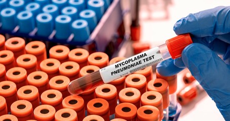 Sticker - Mycoplasma Pneumoniae Test tube with blood sample in infection lab