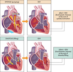 Medical illustration of the two main phases of the cardiac cycle, systole and diastole, with annotations.