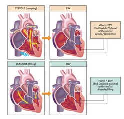 Medical illustration of the two main phases of the cardiac cycle, systole and diastole, with annotations.