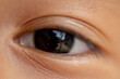 Child's eyes
