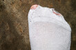 Man toes poking through holes in white socks, hardship concept