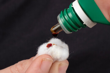 cotton wool and iodine, treatment of radioactive exposure with iodine solution