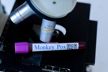 Blood test samples tube, reagent testing tube and swab collection kit in the laboratory,  Monkey pox  testing process. ,PCR DNA testing protocol process.