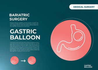 Stomach Endoscopy Gastric Balloon Inside a Stomach weight loss surgery vector illustration obesity 
