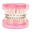 Demonstration teeth with roots model  of orthodontic bracket or brace. Metal braces on teeth on an artificial jaws closeup front view
