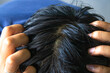 © yandianugrah - Closeup of thick hair on the scalp of a man's head.