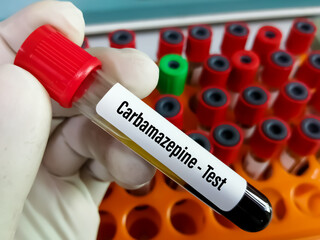 Poster - Blood sample for Carbamazepine test, to establish an appropriate dose and maintain a therapeutic level.