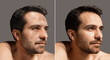 Collage of two portraits of mature man before and after rejuvenation procedure. Face skin aging process. Appearance of wrinkles and sagging skin.