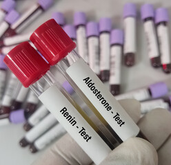 Sticker - Blood samples for Aldosterone and Renin test.