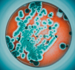 Poster - colonies of microorganisms on the surface of agar in a Petri dish bacteria and fungi from the surface of a cell phone in a Petri dish