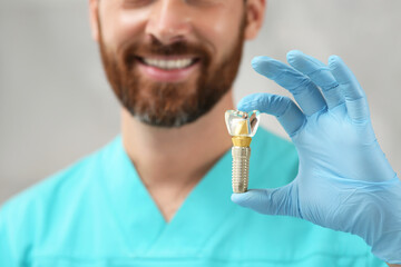 Sticker - Dentist holding educational model of dental implant on blurred background, closeup