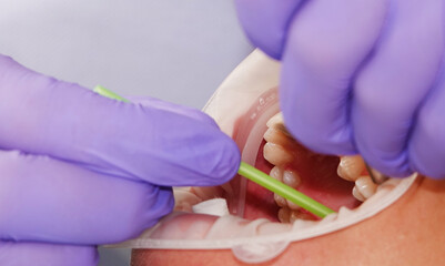 Canvas Print - Dentist doctor working with patient