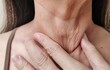 © Rung Kh - close up a hand holding the flabbiness adipose sagging skin, wattle and cellulite under the chin, problem wrinkles and flabby skin under the chin of the woman, health care and beauty concept.