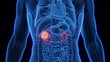 3D Rendered Medical Illustration of Male Anatomy - Kidney Cancer.