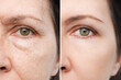 Comparison of the face of young and aged women. Youth, old age. The process of aging and rejuvenation procedures, the result years later. Beauty treatments and lifting. Appearance of wrinkles