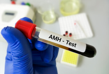 Poster - Blood sample tube for AMH  (anti-mullerian hormone) test, evaluate of ovarian function and fertility in woman