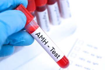 Sticker - AMH test to look for abnormalities from blood