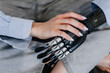 Cropped image of bionic hand prosthesis touching by second hand. Close up of hi tech artificial limb. Young woman in casual clothes with carbon arm. Rehabilitation after trauma. Orthopaedics.