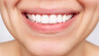 © Марина Демешко - Result of veneers installation. Cropped shot of young caucasian smiling woman demonstrating perfect white even teeth on a white background. Oral hygiene, dental health care. Teeth whitening. Dentistry