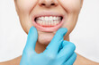 © Марина Демешко - Correct bite. Cropped shot of a young woman's face with doctor's hand in a blue glove showing healthy gums isolated on a white background. Examination at the dentist. Dentistry, dental care
