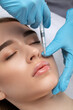 © Dimid - Cosmetologist does injections for lips augmentation and anti wrinkle in the nasolabial folds of a beautiful woman. Women's cosmetology in the beauty salon.