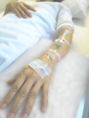 Asian woman patient receiving chemical drugs on drip to blood vessel solution to treat cancer.