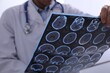 © New Africa - Doctor examining MRI images of patient with multiple sclerosis in clinic, closeup