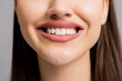 © ABCreative - Opened smiled mouth lips and teeth showing brightening smiled at camera close up shot selective focus.