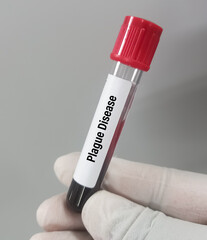 Sticker - Blood sample for plague disease, an infectious disease caused by the bacteria Yersinia pestis.